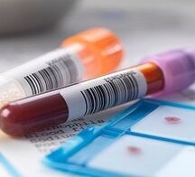 Diagnosticul de laborator al prostatitei
