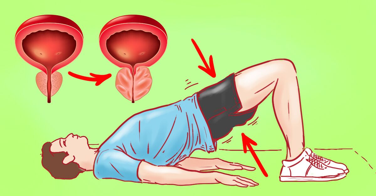 Exerciții terapeutice pentru prostatită cronică