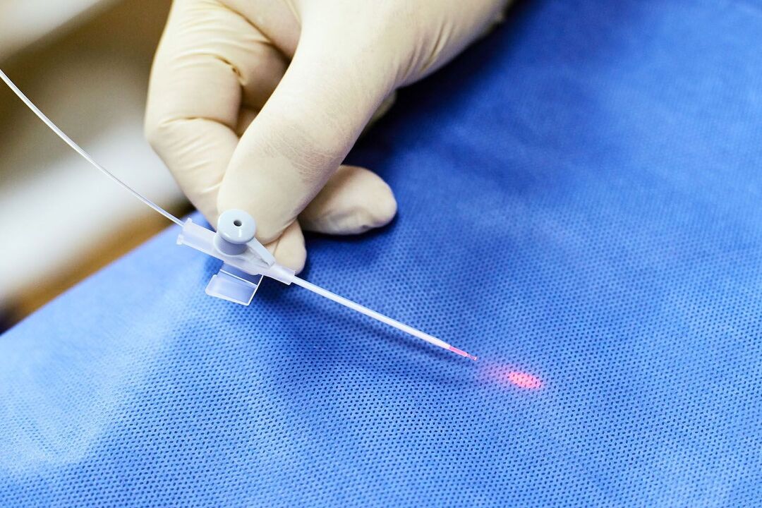 dispozitiv transrectal pentru tratamentul prostatei